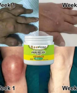 Bee-Venom Gold Pain-Relief Bone Healing Cream