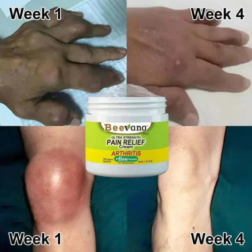 Bee-Venom Gold Pain-Relief Bone Healing Cream