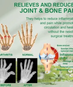 Bee Venom Ultra Strength Pain Relief Cream