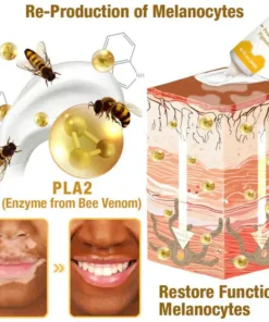 Bee Venom VitiGO Correcting Cream