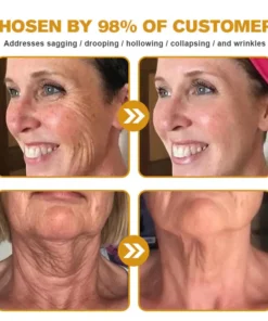 Botox Bee Venom Wrinkle Removal Cream