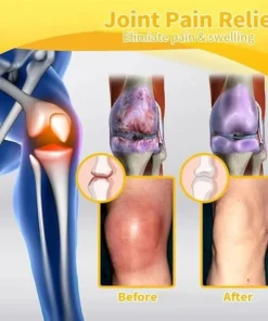 Botulinum Toxin and Bee Venom - Joint | Muscle Pain Cream