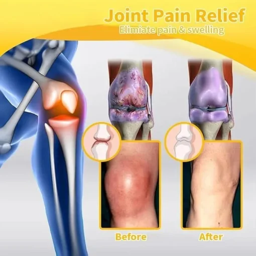 Botulinum Toxin and Bee Venom - Joint | Muscle Pain Cream